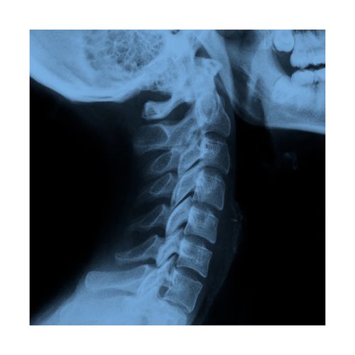 Radiografía de Columna Cervical, 2 posiciones